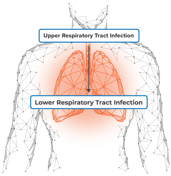 Recurrent infections